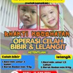 Sambut Hari Bhayangkara ke-80, Polda Jateng Gelar Operasi Gratis Celah Bibir dan Lelangit di RS Bhayangkara Semarang*